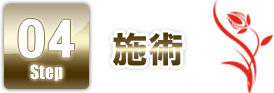 STEP4 施術